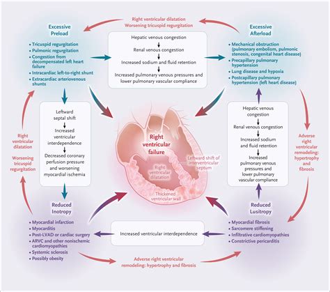 nejm right ventricular failure.